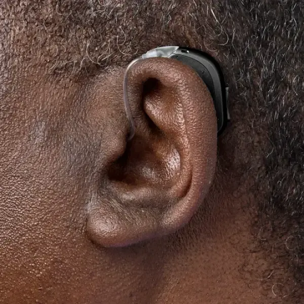 Oticon Intent 3 miniBTE - Ear Man | Oogvoororen