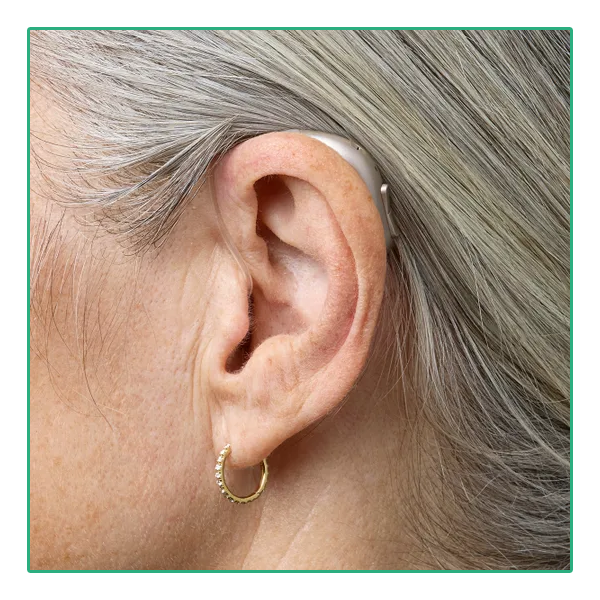 Bernafon Encanta miniBTE R Oplaadbaar - On Ear Woman | Oogvoororen