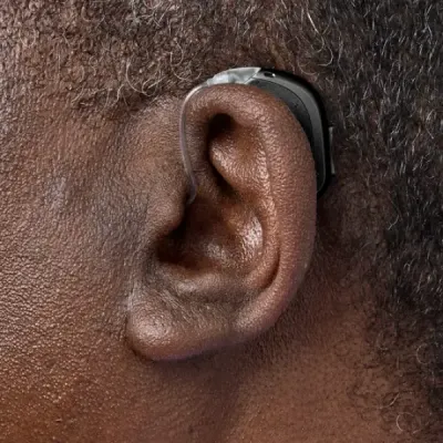 Oticon Intent 1 miniBTE - Ear Man | Oogvoororen
