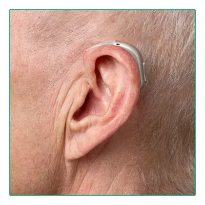 Bernafon Encanta 100 Connect miniBTE Oplaadbaar - On Ear Male | Oogvoororen