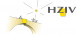 HZIV